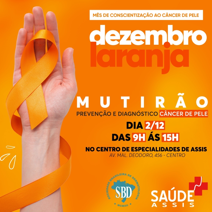 SAÚDE EM MOVIMENTO: um grande mutirão de prevenção e diagnóstico de câncer de pele irá acontecer no Centro de Especialidades de Assis. Programe-se!
