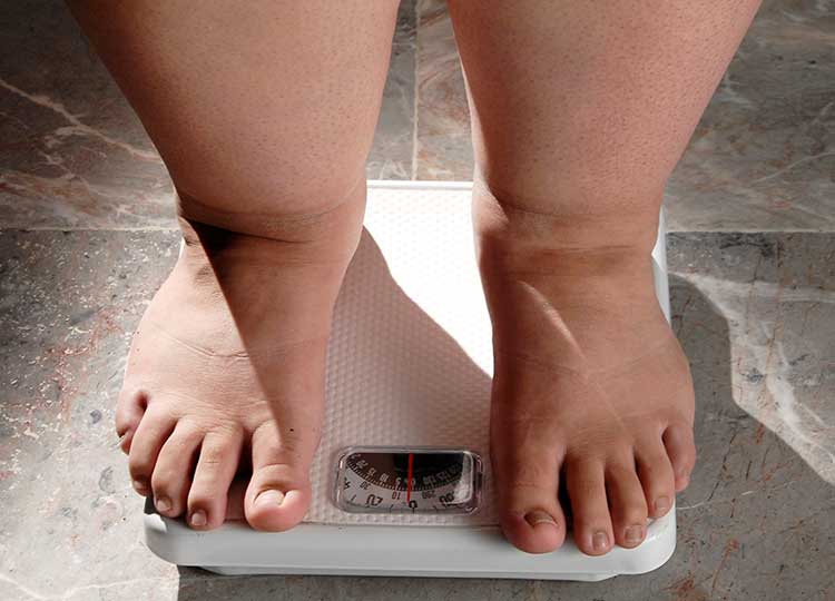 Saúde Assis apresenta formas de combater a obesidade