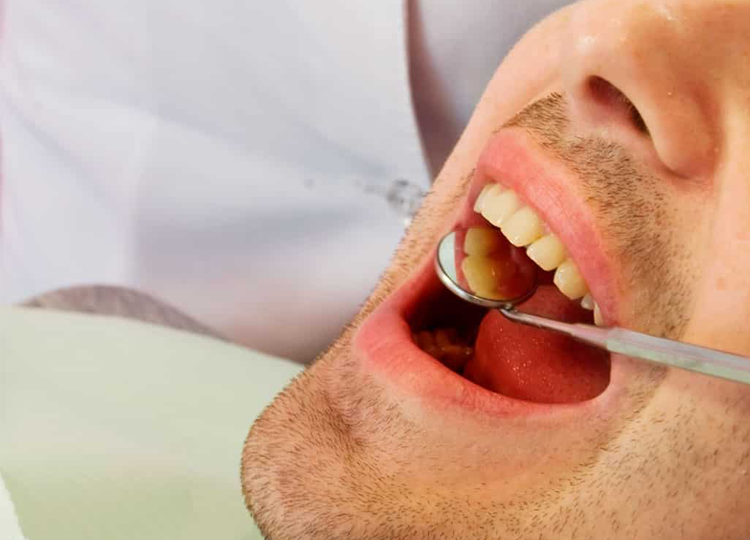 Clínica Odontológica oferece 30% de desconto a servidores e dependentes