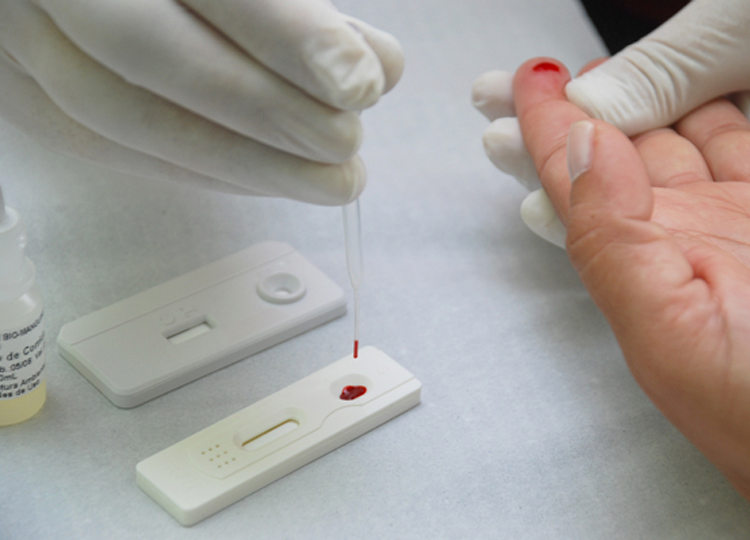 Saúde fará testes rápidos de HIV e Sífilis nessa sexta e sábado