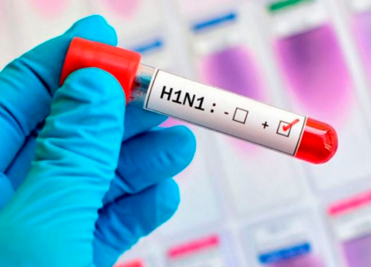 Saúde de Assis faz recomendações sobre H1N1