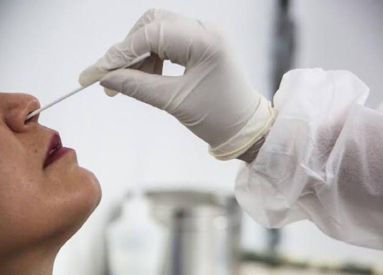 Pacientes sintomáticos serão testados com RT-PCR, padrão-ouro de diagnóstico